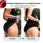 Luminis Vacuvia™ Pro – Tiefenmassage & Hautstraffung