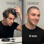 TrimSphere Kabelloser 360°-Rundhaarschneider