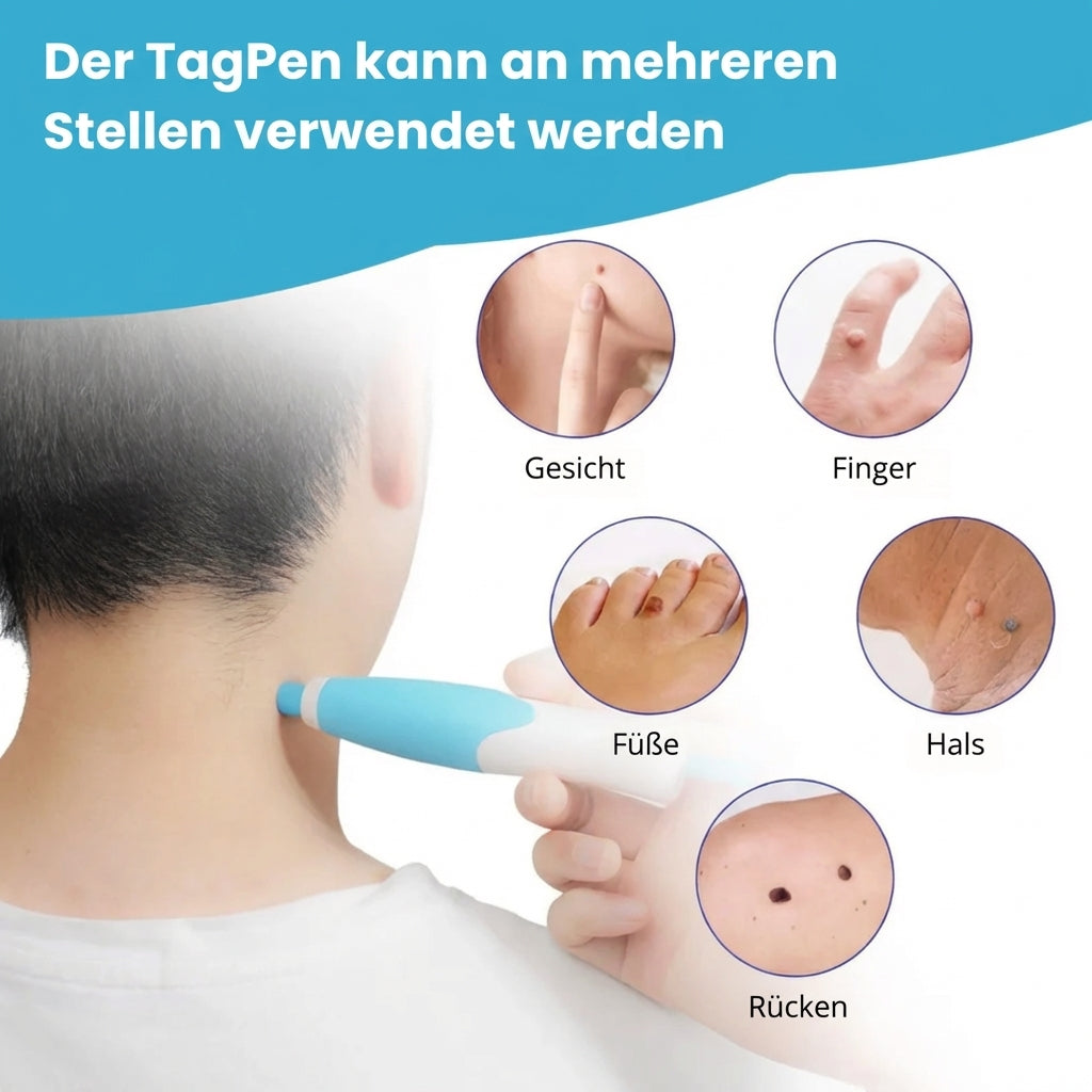 DermaClear™ 2-in-1 Hautanhängsel-Entferner – Glatte Haut ohne Aufwand