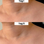 DermaClear™ 2-in-1 Hautanhängsel-Entferner – Glatte Haut ohne Aufwand