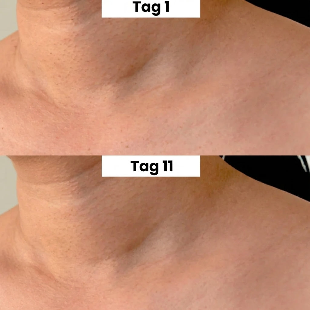 DermaClear™ 2-in-1 Hautanhängsel-Entferner – Glatte Haut ohne Aufwand